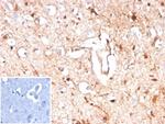 S100B (Astrocyte and Melanoma Marker) Antibody in Immunohistochemistry (Paraffin) (IHC (P))