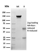 S100B (Astrocyte and Melanoma Marker) Antibody in SDS-PAGE (SDS-PAGE)