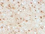 S100B (Astrocyte and Melanoma Marker) Antibody in Immunohistochemistry (Paraffin) (IHC (P))