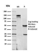 S100B (Astrocyte and Melanoma Marker) Antibody in SDS-PAGE (SDS-PAGE)