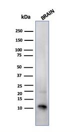 S100B (Astrocyte and Melanoma Marker) Antibody in Western Blot (WB)