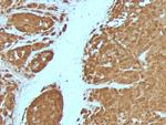 S100B (Astrocyte and Melanoma Marker) Antibody in Immunohistochemistry (Paraffin) (IHC (P))