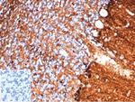 S100B (Astrocyte and Melanoma Marker) Antibody in Immunohistochemistry (Paraffin) (IHC (P))