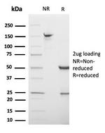 S100B (Astrocyte and Melanoma Marker) Antibody in SDS-PAGE (SDS-PAGE)