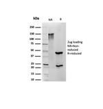 S100B (Astrocyte and Melanoma Marker) Antibody in SDS-PAGE (SDS-PAGE)