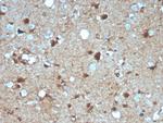 S100B (Astrocyte and Melanoma Marker) Antibody in Immunohistochemistry (Paraffin) (IHC (P))