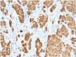 S100B Antibody in Immunohistochemistry (Paraffin) (IHC (P))