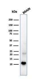 S100B Antibody in Western Blot (WB)