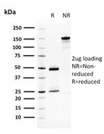 Squamous Cell Carcinoma Antigen 1 Antibody in SDS-PAGE (SDS-PAGE)