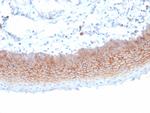 CD138/Syndecan-1 (SDC1) (Plasma Cell Marker) Antibody in Immunohistochemistry (Paraffin) (IHC (P))