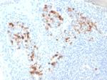 CD138/Syndecan-1 (SDC1) (Plasma Cell Marker) Antibody in Immunohistochemistry (Paraffin) (IHC (P))