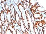 SDHA (Succinate Dehydrogenase Complex Flavoprotein Subunit A) Antibody in Immunohistochemistry (Paraffin) (IHC (P))