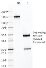 SDHB (Succinate Dehydrogenase B) (Pheochromocytoma Marker) Antibody in SDS-PAGE (SDS-PAGE)