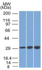 SDHB (Succinate Dehydrogenase B) (Pheochromocytoma Marker) Antibody in Western Blot (WB)