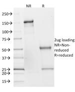 SDHB (Succinate Dehydrogenase B) (Pheochromocytoma Marker) Antibody in SDS-PAGE (SDS-PAGE)