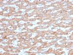 SDHB (Succinate Dehydrogenase B) (Pheochromocytoma Marker) Antibody in Immunohistochemistry (Paraffin) (IHC (P))