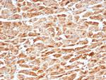 SDHB (Succinate Dehydrogenase B) Antibody in Immunohistochemistry (Paraffin) (IHC (P))