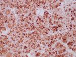 SDHB (Succinate Dehydrogenase B) Antibody in Immunohistochemistry (Paraffin) (IHC (P))