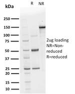 Calcineurin B homologous protein 2/HCC Antigen 520 Antibody in SDS-PAGE (SDS-PAGE)