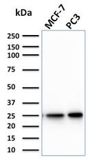 Calcineurin B homologous protein 2/HCC Antigen 520 Antibody in Western Blot (WB)