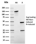 Sex Hormone Binding Globulin (SHBG) Antibody in Immunoelectrophoresis (IE)