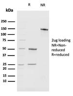 BMI1 Antibody in SDS-PAGE (SDS-PAGE)