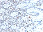 BMI1 Antibody in Immunohistochemistry (Paraffin) (IHC (P))