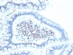 BMI1 Antibody in Immunohistochemistry (Paraffin) (IHC (P))