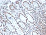 BMI1 Antibody in Immunohistochemistry (Paraffin) (IHC (P))