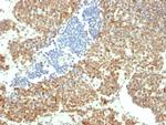 BMI1 Antibody in Immunohistochemistry (Paraffin) (IHC (P))