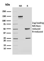 BMI1 Antibody in SDS-PAGE (SDS-PAGE)