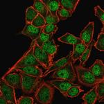 BMI1 Antibody in Immunocytochemistry (ICC/IF)