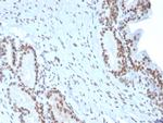 BMI1 Antibody in Immunohistochemistry (Paraffin) (IHC (P))