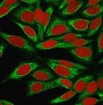 CDw75 (B-Cell Marker) Antibody in Immunocytochemistry (ICC/IF)