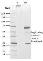 CDw75 (B-Cell Marker) Antibody in SDS-PAGE (SDS-PAGE)