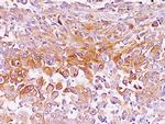 Melanosome gp100/PMEL17/SILV (Melanoma Marker) Antibody in Immunohistochemistry (Paraffin) (IHC (P))