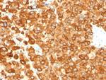 gp100/Melanosome/PMEL17/SILV Antibody in Immunohistochemistry (Paraffin) (IHC (P))