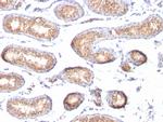 gp100/Melanosome/PMEL17/SILV Antibody in Immunohistochemistry (Paraffin) (IHC (P))