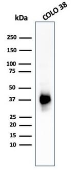 gp100/Melanosome/PMEL17/SILV Antibody in Western Blot (WB)