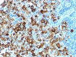 gp100/Melanosome/PMEL17/SILV Antibody in Immunohistochemistry (Paraffin) (IHC (P))