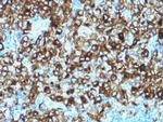 gp100/Melanosome/PMEL17/SILV (Melanoma Marker) Antibody in Immunohistochemistry (Paraffin) (IHC (P))