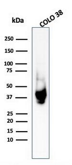 gp100/Melanosome/PMEL17/SILV (Melanoma Marker) Antibody in Western Blot (WB)