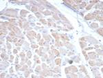 Somatostatin receptor type 2 (SS2R)/SSTR2 Antibody in Immunohistochemistry (Paraffin) (IHC (P))