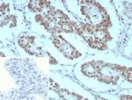 Integrase interactor 1 (INI-1)/SNF5/SMARCB1 Antibody in Immunohistochemistry (Paraffin) (IHC (P))