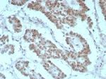 Integrase interactor 1 (INI-1)/SNF5/SMARCB1 Antibody in Immunohistochemistry (Paraffin) (IHC (P))