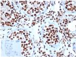 Integrase interactor 1 (INI-1)/SNF5/SMARCB1 Antibody in Immunohistochemistry (Paraffin) (IHC (P))