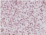 Integrase interactor 1 (INI-1)/SNF5/SMARCB1 Antibody in Immunohistochemistry (Paraffin) (IHC (P))