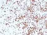 Integrase interactor 1 (INI-1)/SNF5/SMARCB1 Antibody in Immunohistochemistry (Paraffin) (IHC (P))