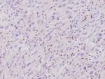 Integrase interactor 1 (INI-1)/SNF5/SMARCB1 Antibody in Immunohistochemistry (Paraffin) (IHC (P))