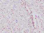 Integrase interactor 1 (INI-1)/SNF5/SMARCB1 Antibody in Immunohistochemistry (Paraffin) (IHC (P))